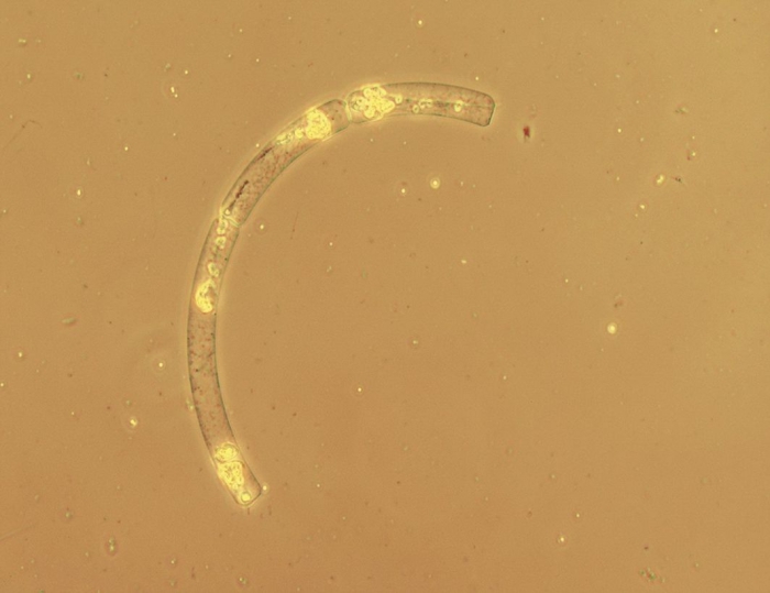 Guinardia striata