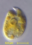 Amphidinium carterae Amphidinium carterae