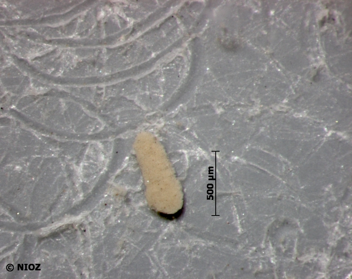 Scypha cf. ciliata (Fabricius, 1780)