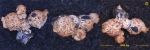 Foraminifera