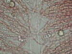 Protozoa