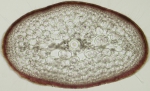 Sphaerococcus coronopifolius