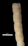 Zeuctocrinus gisleni AM Clark, 1973 HOLO BMNH 1972.12.5.4