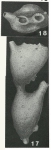 Aschemonella scabra Brady, 1879