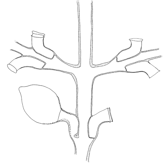 Synthecium flabellum, part of stem and bases of branches, one gonotheca arising from hydrotheca