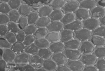 Bryozoa