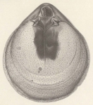 Armpotigen