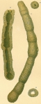 Archimerismus subnodosus