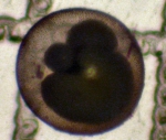Orbulina