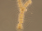 Chaetoceros debilis