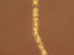 Chaetoceros compressus