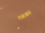Chaetoceros debilis