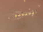 Chaetoceros laciniosus
