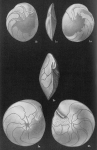 Amphistegina madagascariensis
