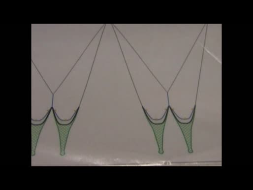 Twinrig
