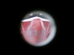 Simon Stevin (Bow tru eye)