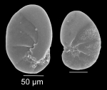 Nonionella stella Cushman & Moyer, 1930 Nonionella stella Cushman & Moyer, 1930