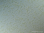 Nannochloropsis cells