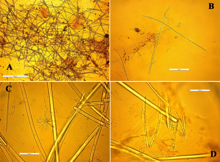 Cornulotrocha cheliradians skeleton and spicules