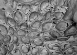 Bryozoa