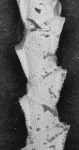 Bryozoa