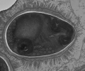 Areospora rohanae
