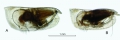 Conchoecetta giesbrechti (G.W. Müller, 1906)