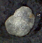 Protozoa