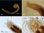 Protodrilus puniceus figure 1.