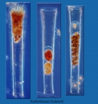 parasitised tintinnid or 