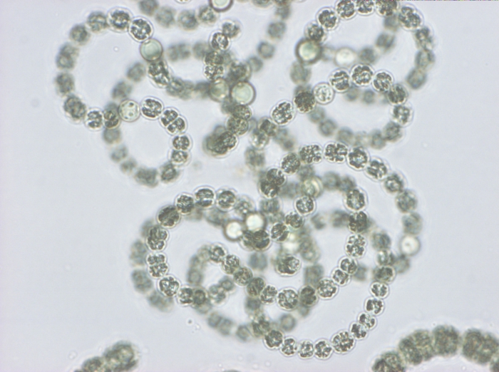 Anabaena flos-aquae Bréb. ex Born. et Flah. 1888