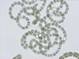 Anabaena flos-aquae Br. ex Born. et Flah. 1888, author: Moestrup, vind