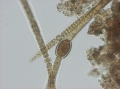 Anabaena bergii Ostenfeld 1908