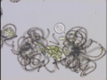 Anabaena lemmermannii