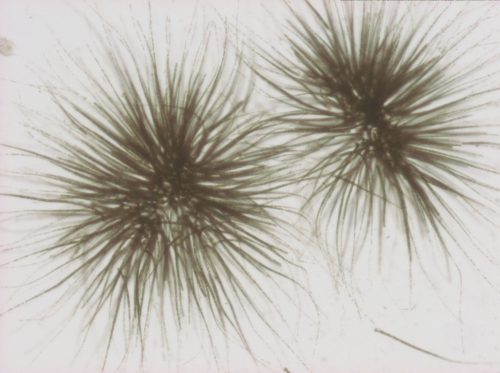 Gloeotrichia echinulata Gloeotrichia echinulata