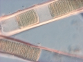 Lyngbya majuscula 400x