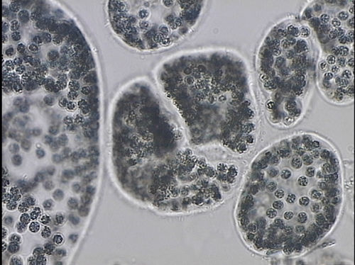 Microcystis wesenbergii Microcystis wesenbergii