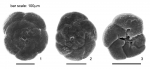 Lepidodeuterammina eddystonensis Brönnimann & Whittaker, 1990