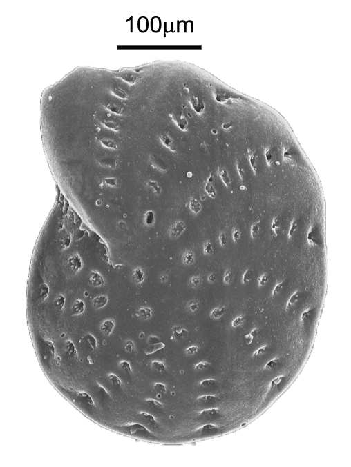 Elphidium advenum (Cushman, 1922) Elphidium advenum (Cushman, 1922)