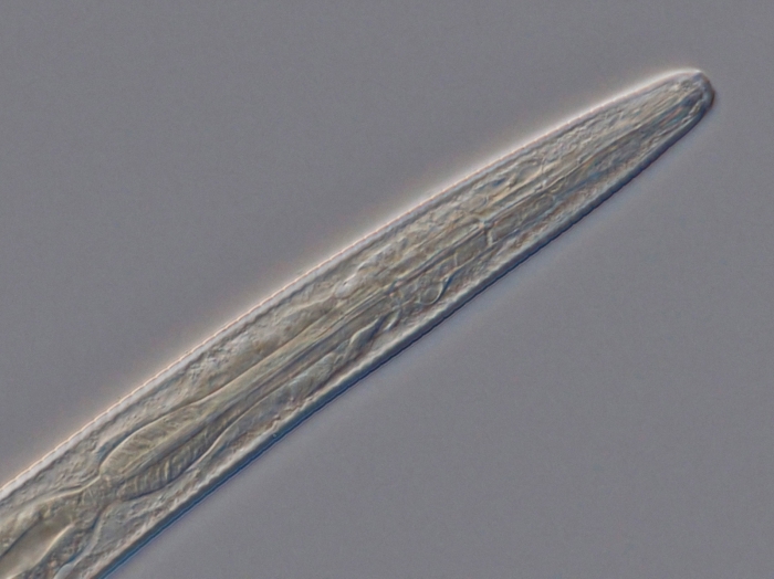 Holotype male anterior end of Antomicron quindecimpapillatus