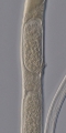 Holotype female midbody of Domorganus suecicus, author: Holovachov, Oleksandr