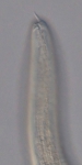 Holotype female anterior end of Loveninema unicornis
