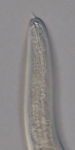 Holotype female anterior end of Loveninema unicornis