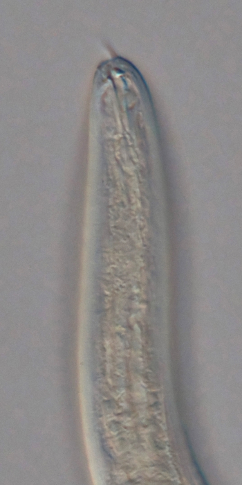 Holotype female anterior end of Loveninema unicornis