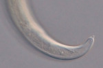 Holotype female posterior end of Loveninema unicornis