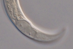 Holotype female posterior end of Loveninema unicornis