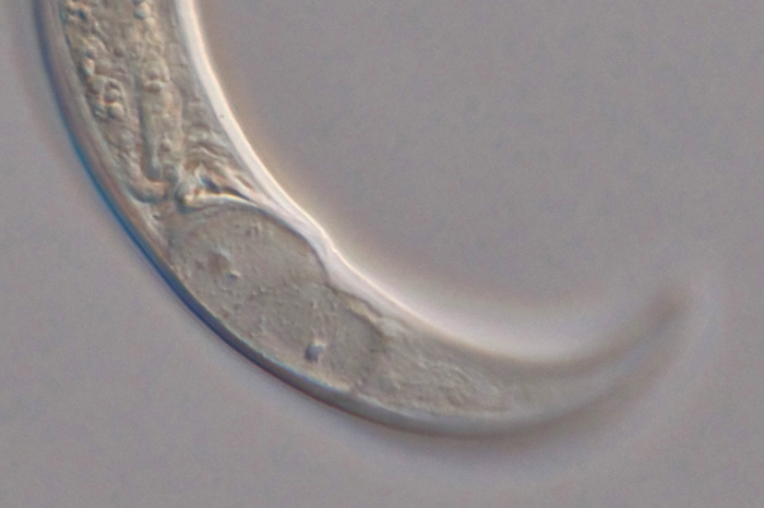 Holotype female posterior end of Loveninema unicornis