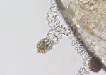 Hydrozoa (hydroids)