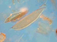 Ciliata