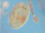 Platyhelminthes